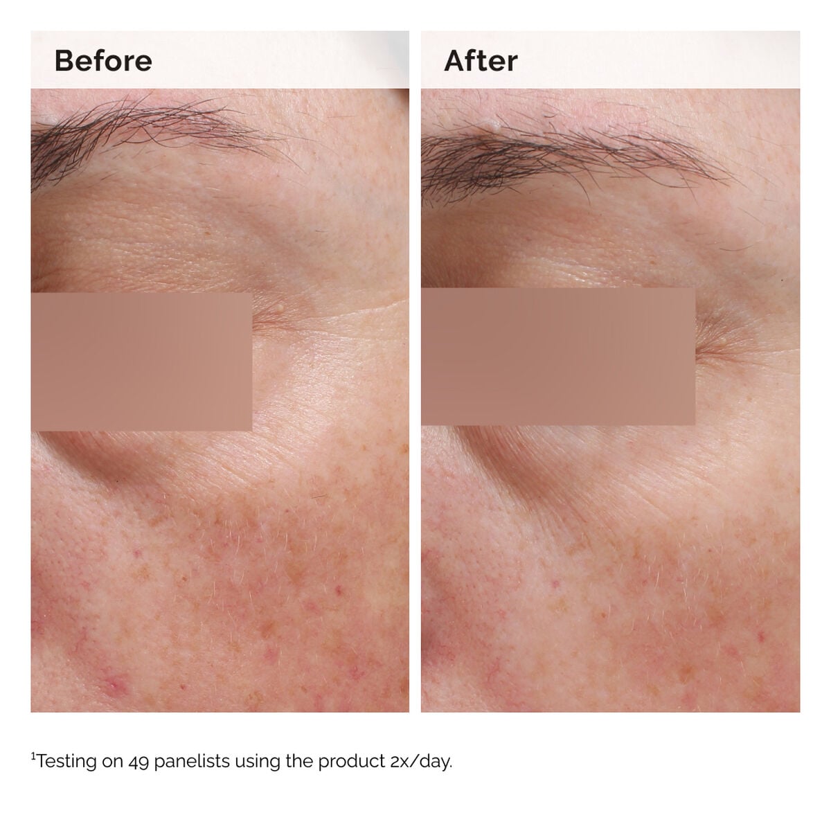 niacinamide-5-face-and-body-emulsion-h9 2024-08-23-ORD-Nia-5pct-Face-Body-B-A-Elasticity-Global-02-1x1.jpg