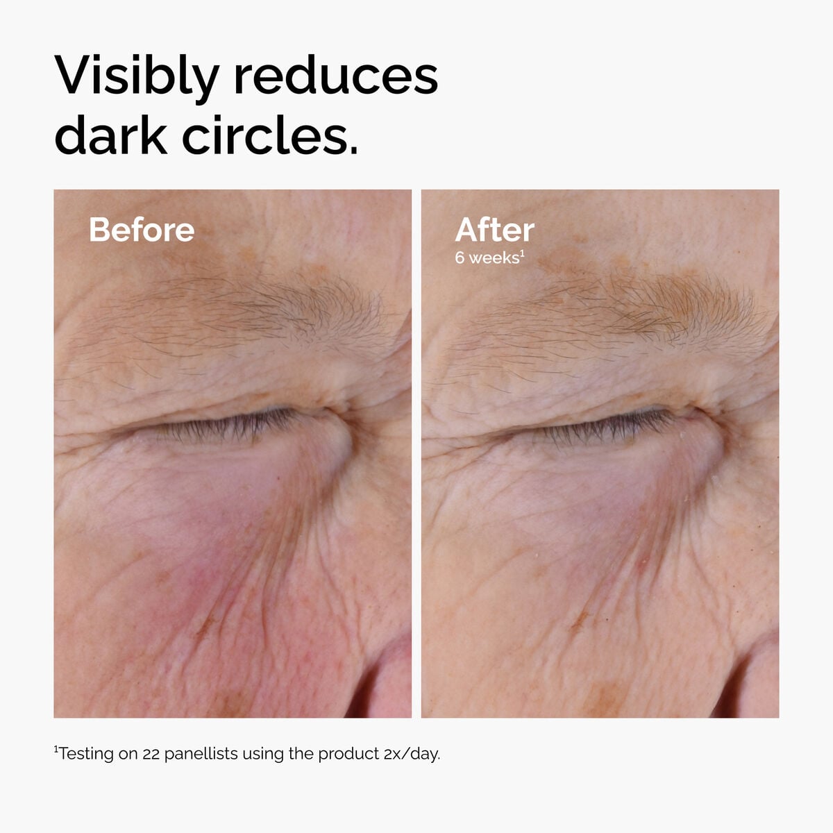caffeine-solution-5-egcg-eye-serum-y2 ord-caffeine-solution-egcg-dark-circles-before-after.jpg