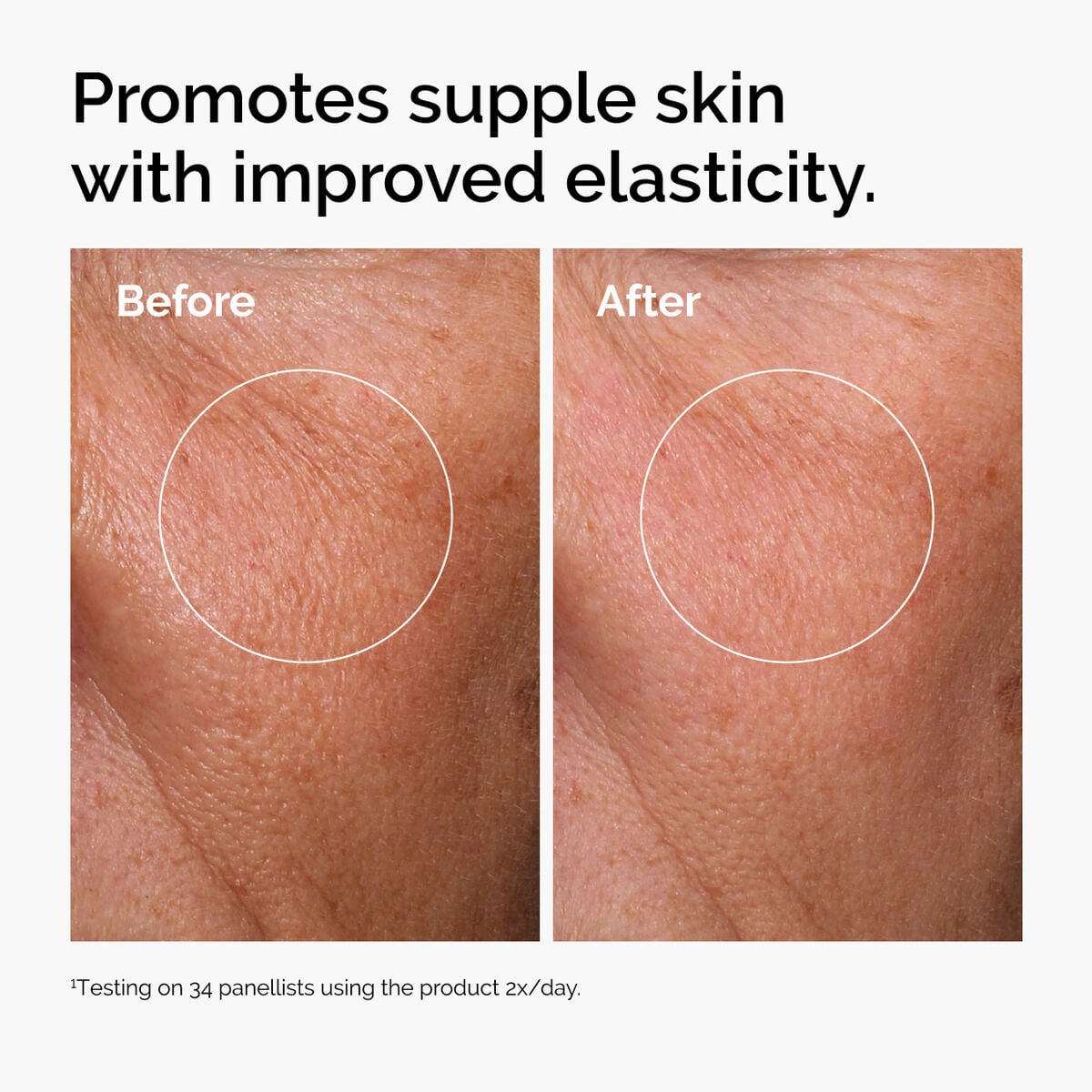hyaluronic-acid-2-b5-with-ceramides-t6 ord-hyaluronic-acid-2pct-b5-hydrating-serum-before-after-elasticity.jpg