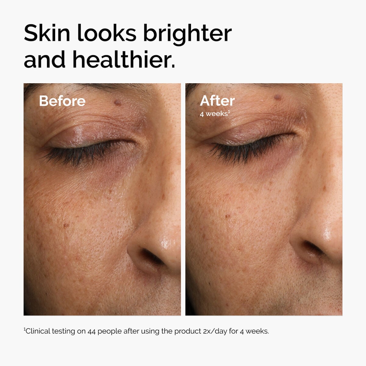multi-antioxidant-radiance-serum-u4 ord-mars-before-after-healthy.jpg