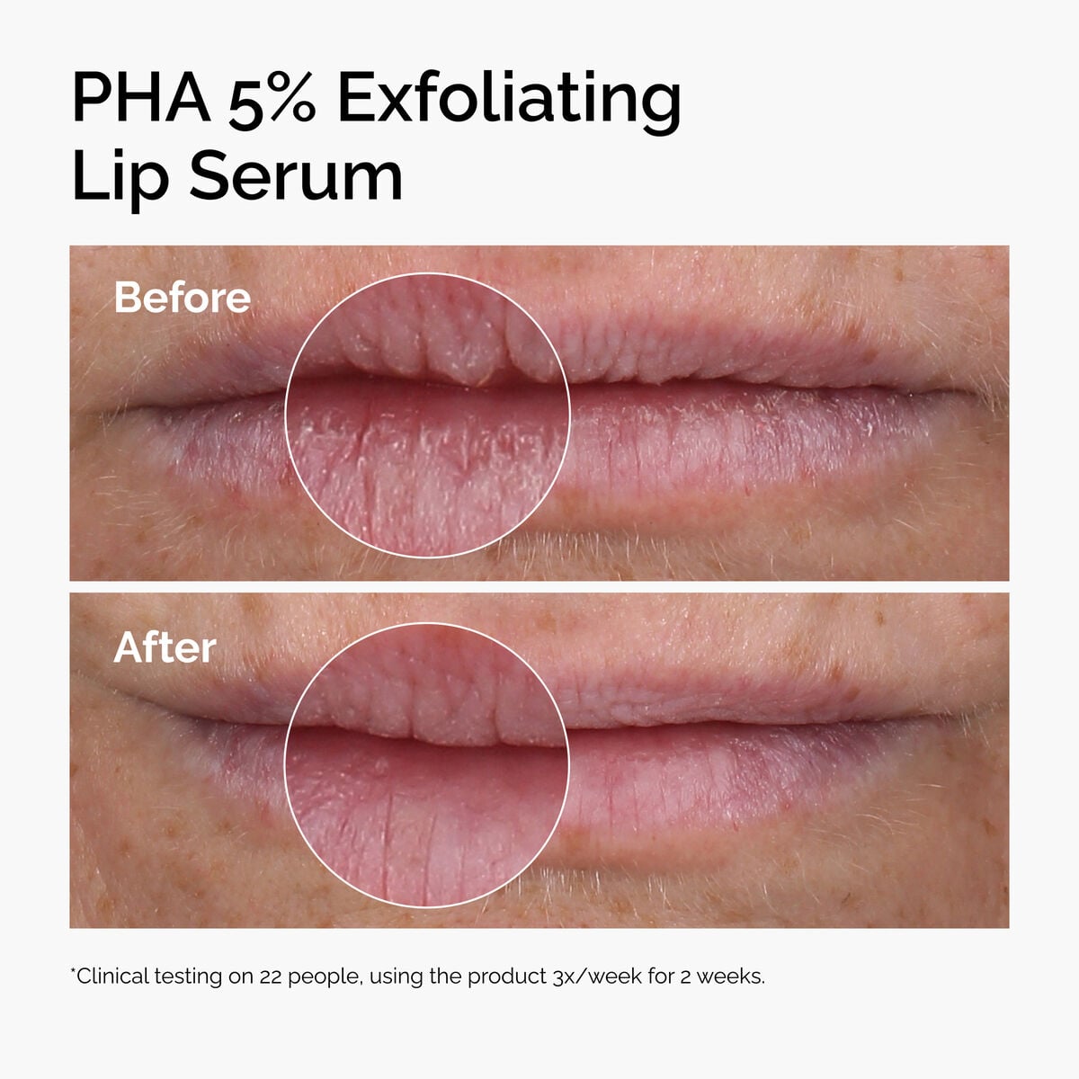 pha-5-exfoliating-lip-serum-g4 ord-pha-5pct-lip-exfoliating-serum-before-after.jpg